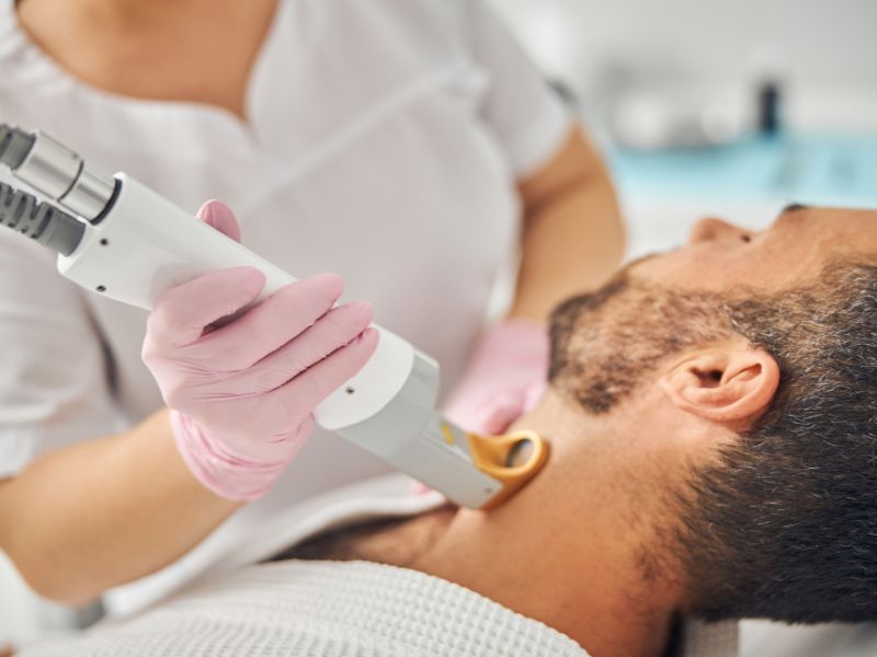 faixa de barba depilação a laser benefícios