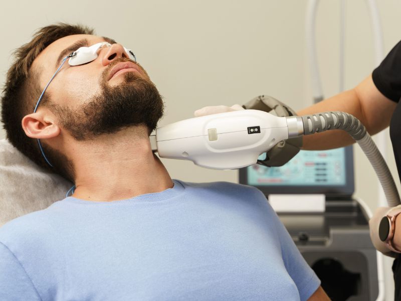 faixa de barba depilação a laser cuidados