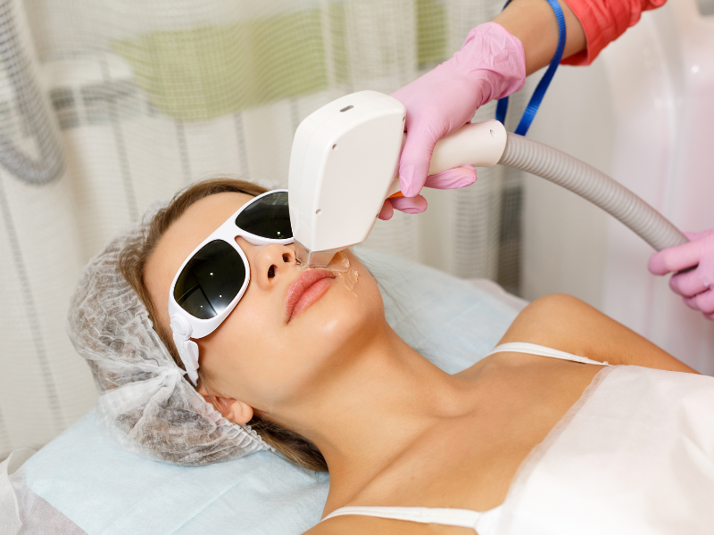 depilação a laser no rosto procedimento