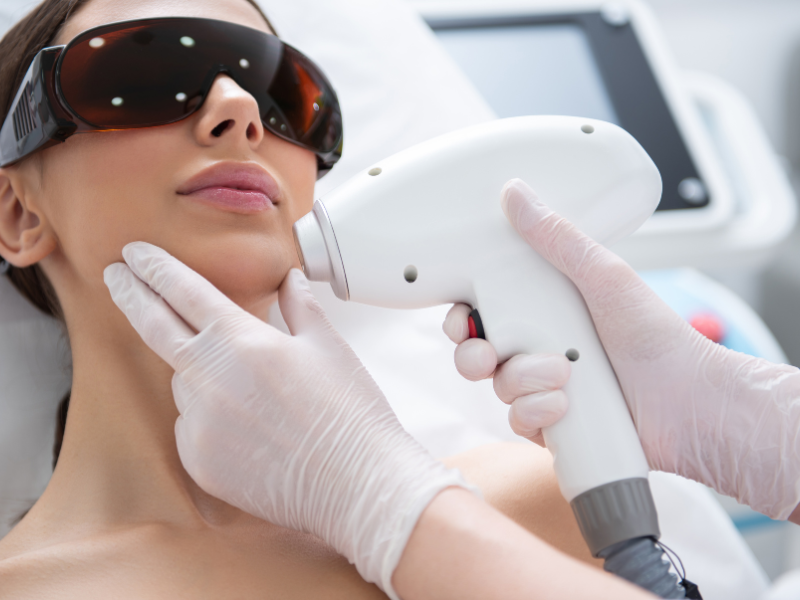 áreas para depilação a laser o que é