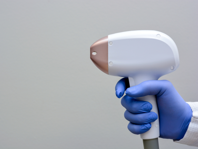 depilação a laser buço procedimento
