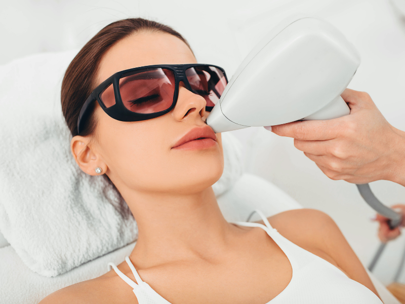 quem faz depilação a laser pode usar ácido hialurônico procedimento